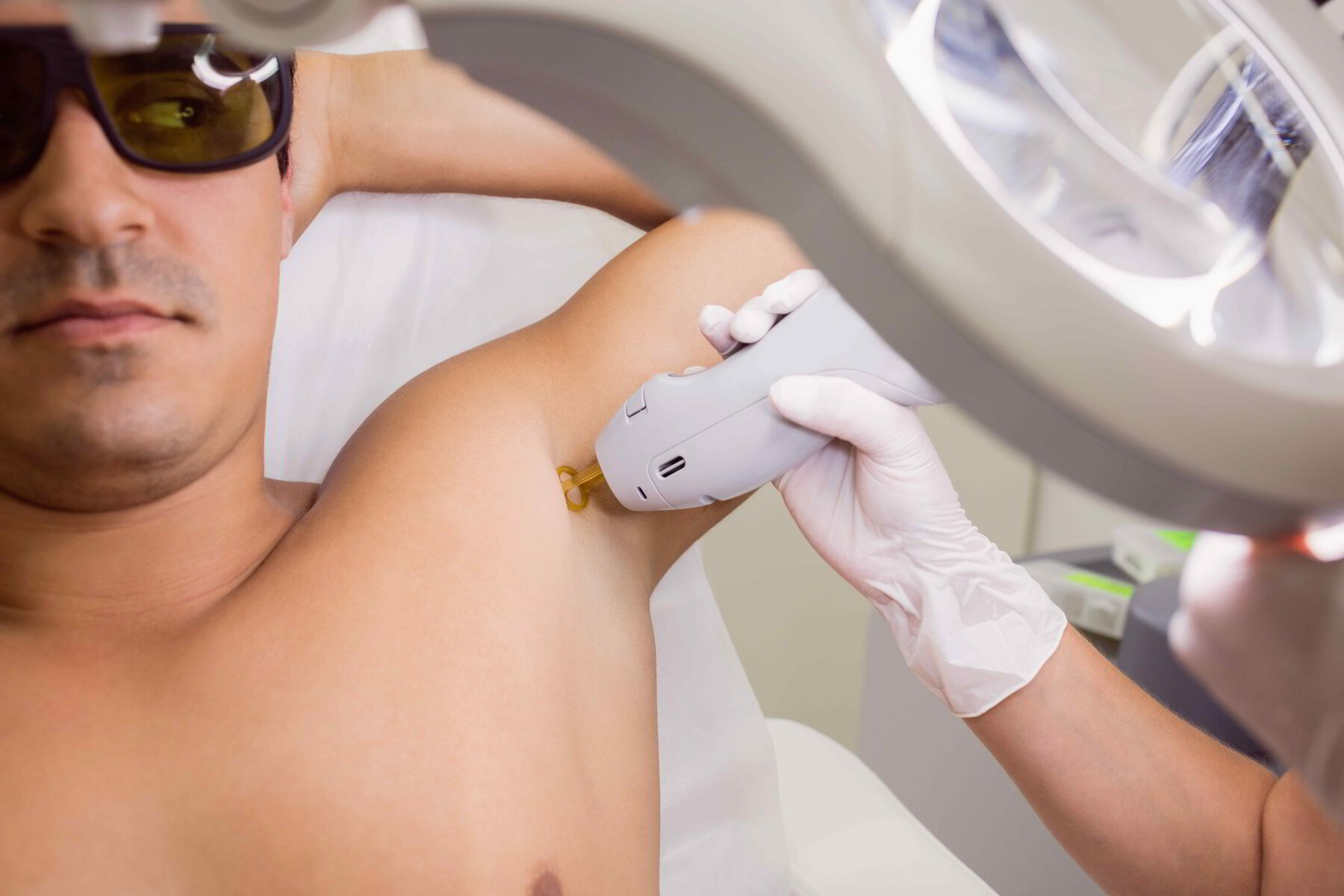 Laser Hair Removal Treatment: What Is It And How Does It Work? – Derma  Miracle