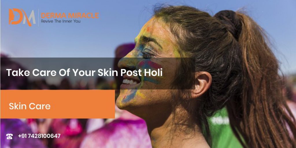 Take Care Of Your Skin Post-Holi – Derma Miracle