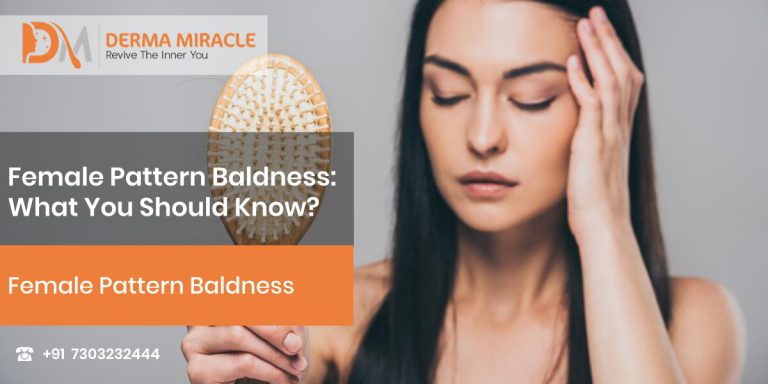 Female Pattern Baldness What You Should Know Derma Miracle 3769