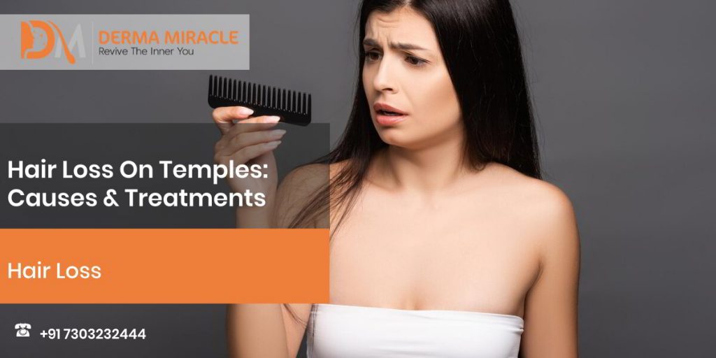 Hair Loss On Temples: Causes & Treatments – Derma Miracle