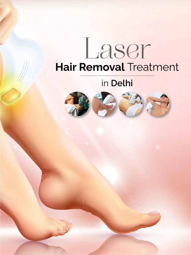 Laser Hair Removal new Derma Miracle Clinic Delhi