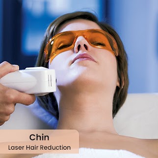 Chin Laser Hair Removal