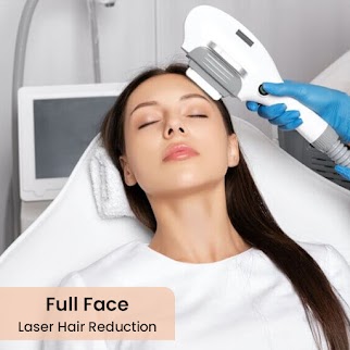 Full Face Laser Hair Removal